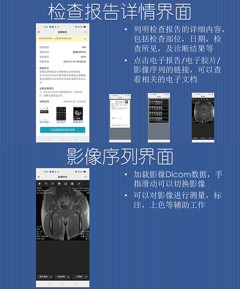医院放射透视检测报告电子胶片检查报告云管理系统软件开发APP小程序定制 医院放射透视检测报告电子胶片检查报告云管理系统软件开发APP小程序定制
